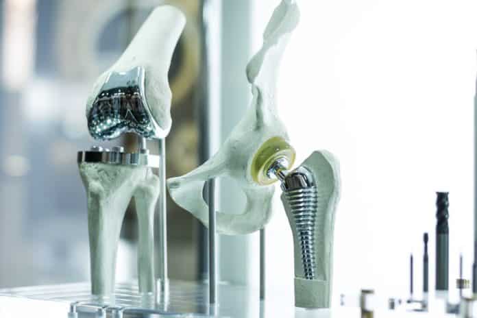alloys Low-cost alloys would pave the way for affordable medical implants and prosthetics. Monstar Studio/Shutterstock